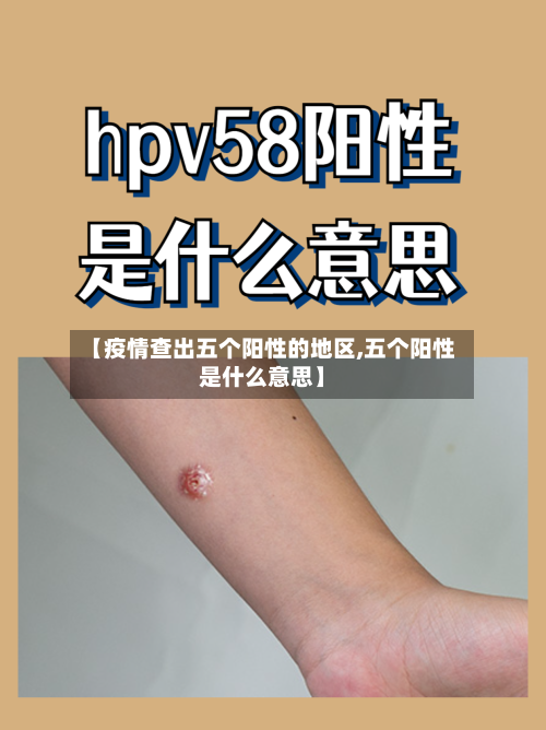 【疫情查出五个阳性的地区,五个阳性是什么意思】-第3张图片