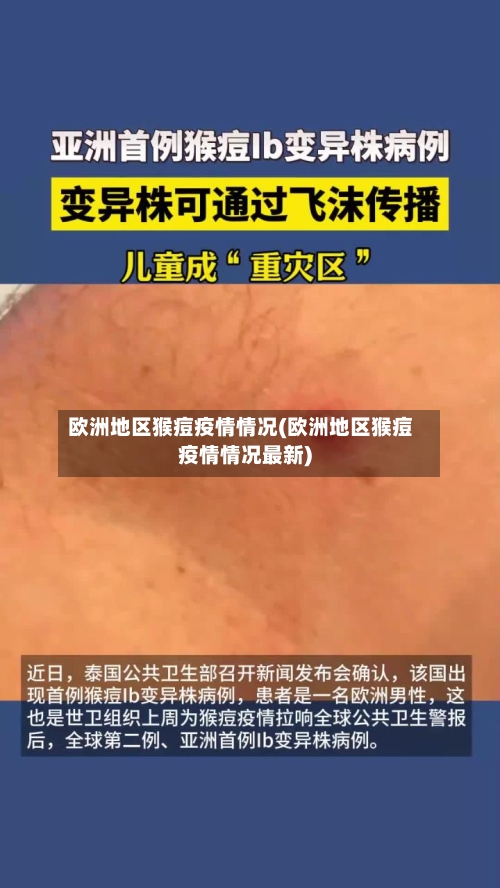 欧洲地区猴痘疫情情况(欧洲地区猴痘疫情情况最新)-第2张图片