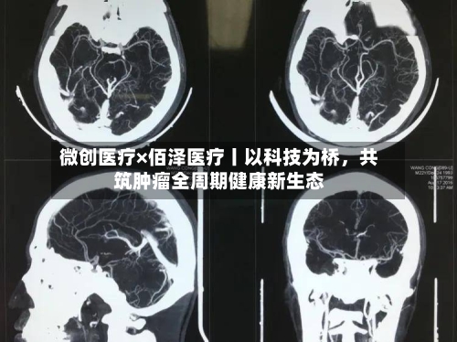 微创医疗×佰泽医疗丨以科技为桥	，共筑肿瘤全周期健康新生态-第2张图片