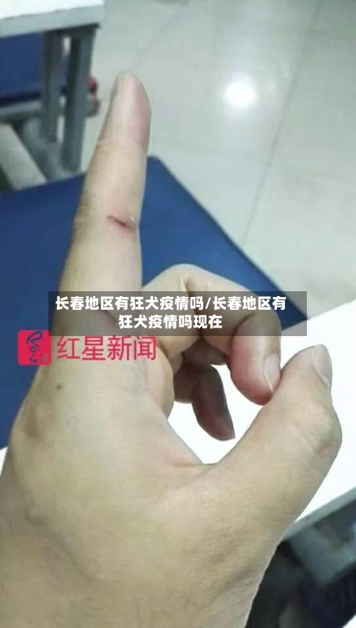 长春地区有狂犬疫情吗/长春地区有狂犬疫情吗现在