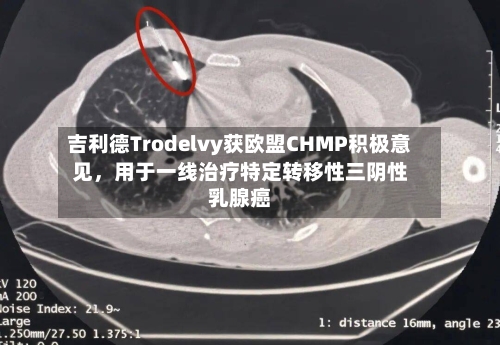 吉利德Trodelvy获欧盟CHMP积极意见，用于一线治疗特定转移性三阴性乳腺癌